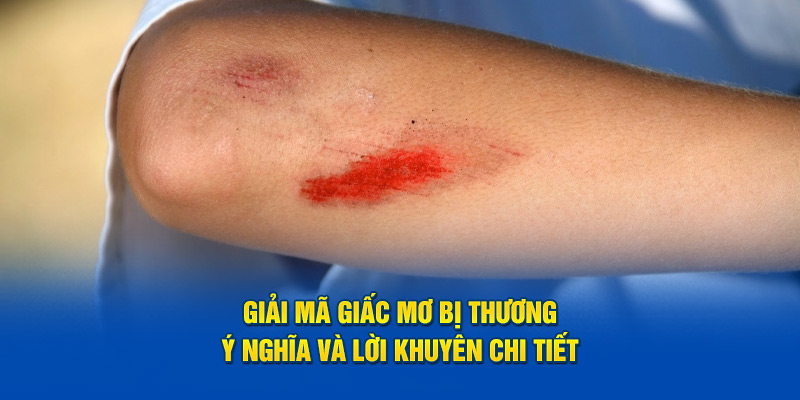 Giải Mã Giấc Mơ Bị Thương - Mơ Bị Thương Do Đâu 1 Giải mã giấc mơ bị thương do đâu